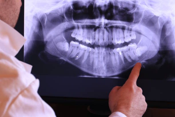 Best Walk-In Emergency Dentist in Knightstown, IN